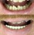 6dbf0042ba6ad8661ba9c6e6e018d92f