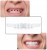 fd04b56b6614336df1b9021d26944925